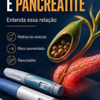 CANETINHAS E PANCREATITE: QUAL A RELAÇÃO?