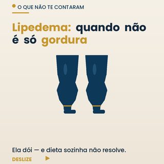 Lipedema: quando não é só gordura — e não é falta de dieta